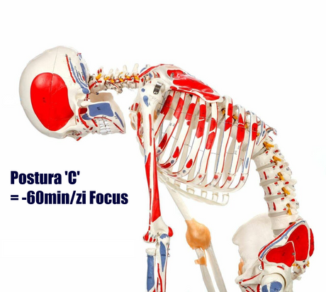 Model biomecanic postura C colaps coloana vertebrala si tensiune musculara - impact incarcare cognitiva